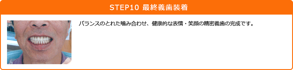 STEP10 最終義歯装着