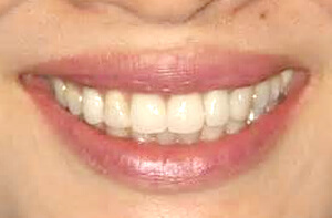 患者様の美しい歯