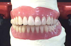 リハビリ用入れ歯による治療の中で、筋肉のリハビリや訓練も行います