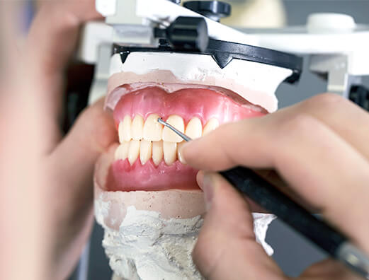 義歯専門歯科技工士が制作
