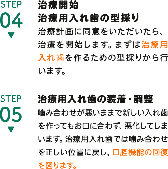 STEP4 治療開始-治療用入れ歯の型採り, STEP5 治療用入れ歯の装着・調整