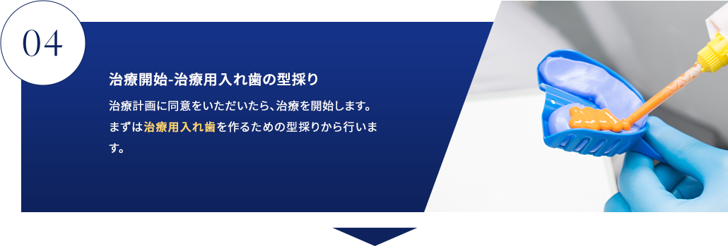 STEP04 治療開始-治療用入れ歯の型採り