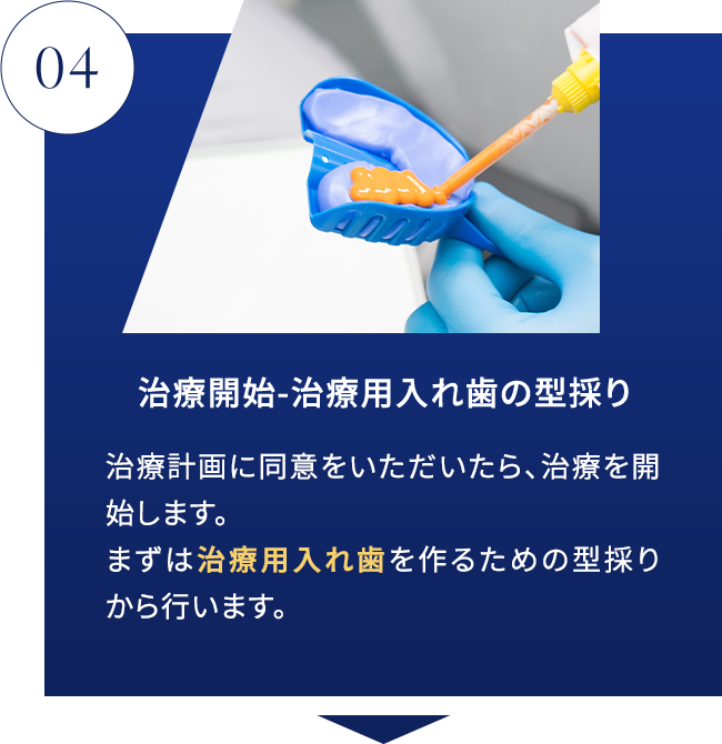 STEP04 治療開始-治療用入れ歯の型採り