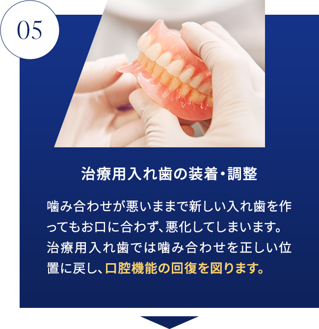 STEP05 治療用入れ歯の装着・調整