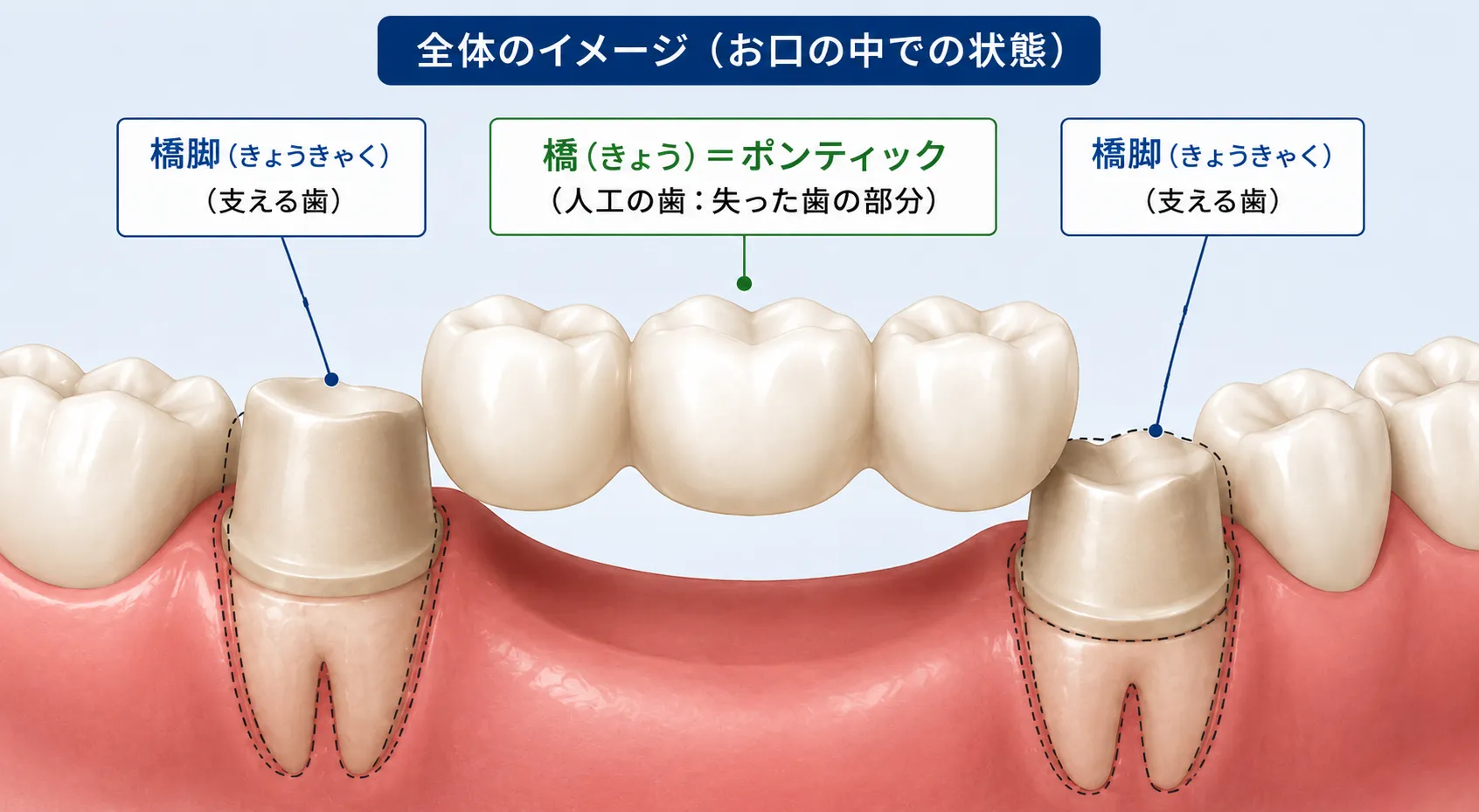ブリッジの構造(橋脚と橋の仕組み)