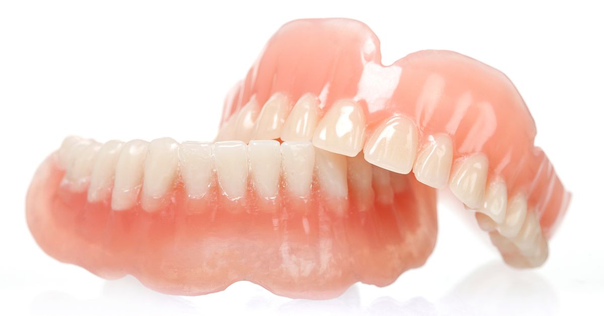 ノンクラスプデンチャー(バネのない入れ歯)とは