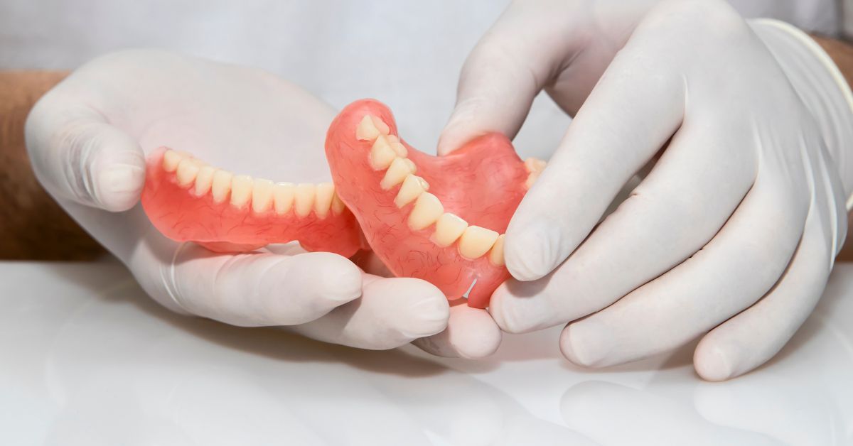 【徹底比較】ノンクラスプデンチャーの費用相場と他治療との違い